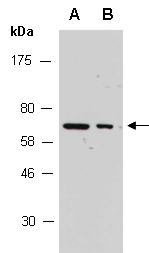 ARIH2 Antibody Western (Abiocode)