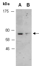 SOX8 Antibody Western (Abiocode)