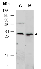 betatrophin Antibody Western (Abiocode)