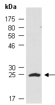 POMC Antibody Western (Abiocode)