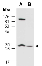 SOCS3 Antibody Western (Abiocode)