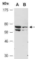 IRAK1 Antibody Western (Abiocode)