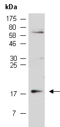 CDKN2A Antibody Western (Abiocode)