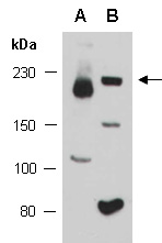 TIAM1 Antibody Western (Abiocode)