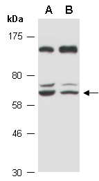 ZBTB9 Antibody Western (Abiocode)