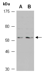 FZD5 Antibody Western (Abiocode)