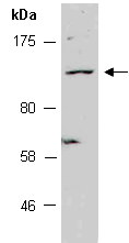 FBXO11 Antibody Western (Abiocode)
