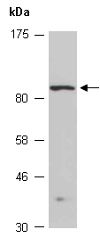 NTRK3 Antibody Western (Abiocode)