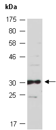 HOXB1 Antibody Western (Abiocode)