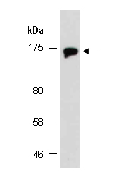 ATXN2 Antibody Western (Abiocode)