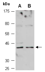 LHX3 Antibody Western (Abiocode)