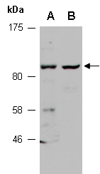 ARHGAP26 Antibody Western (Abiocode)