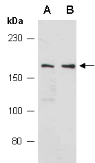 PHLPP1 Antibody Western (Abiocode)
