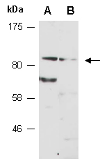 HMGCR Antibody Western (Abiocode)
