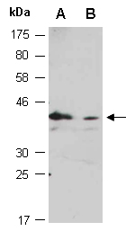 STX17 Antibody Western (Abiocode)