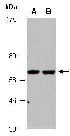 PINK1 Antibody Western (Abiocode)