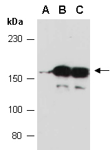 SLX4 Antibody Western (Abiocode)