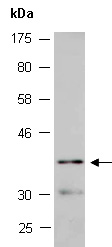 CSNK1A1 Antibody Western (Abiocode)