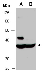 CSNK1A1 Antibody Western (Abiocode)