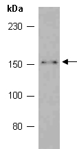 ACE Antibody Western (Abiocode)