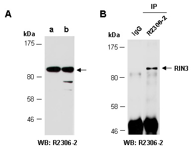 RIN3 Western IP Antibody (Abiocode)