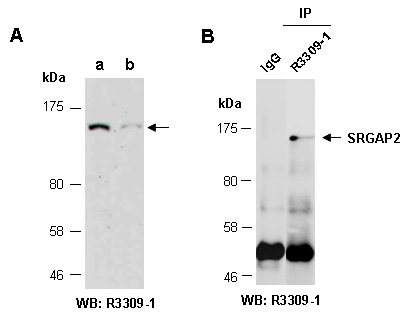 SRGAP2 Western IP Antibody (Abiocode)