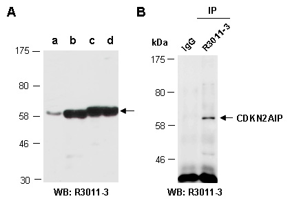 CDKN2AIP Western IP Antibody (Abiocode)
