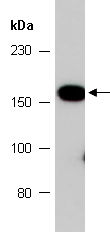 ASXL1 Antibody Western Abiocode