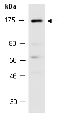 IRS2 Antibody Western (Abiocode)