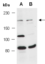 IRS2 Antibody Western (Abiocode)