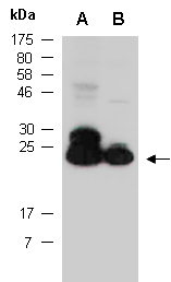 COMMD3 Antibody Western (Abiocode)