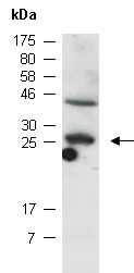 COMMD3 Antibody Western (Abiocode)