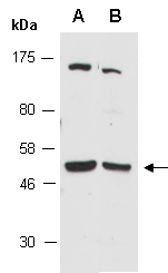 CFLAR Antibody Western (Abiocode)