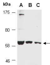 PRKAA1 Antibody Western (Abiocode)