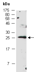 ID1 Antibody Western (Abiocode)