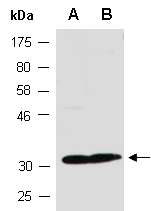 CCND2 Antibody Western (Abiocode)
