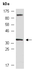 HOXA4 Antibody Western (Abiocode)