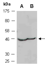 ARRB2 Antibody Western (Abiocode)