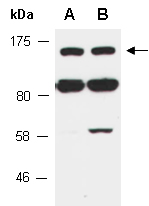 SMC5 Antibody Western (Abiocode)