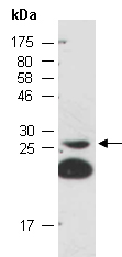 SIKE1 Antibody Western (Abiocode)