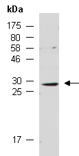 NEUROG3 Antibody Western (Abiocode)