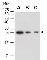 COMMD1 Antibody Western (Abiocode)