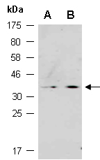 MAGEB2 Antibody Western (Abiocode)