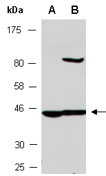 ZDHHC2 Antibody Western (Abiocode)