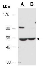 ZSCAN21 Antibody Western (Abiocode)