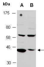MAPK13 Antibody Western (Abiocode)