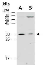 TPSAB1 Antibody Western (Abiocode)