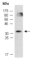 HOXA11 Antibody Western (Abiocode)