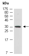 MMP26 Antibody Western (Abiocode)