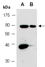 PCSK9 Antibody Western (Abiocode)